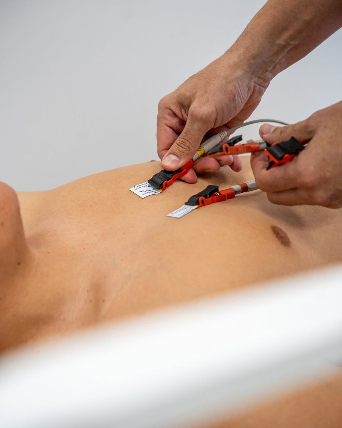 Servicio de enfermería clínica en evolutiondf — electrocardiograma y cuidados